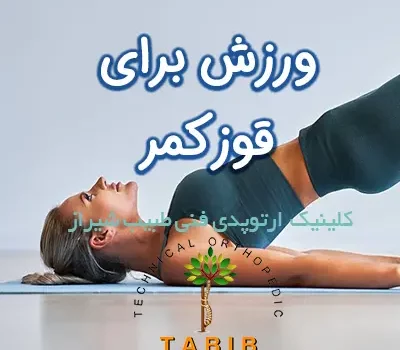 ورزش برای قوز کمر