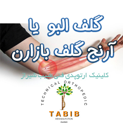 درمان گلف البو در شیراز